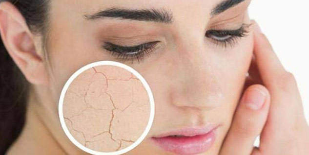 dry skin