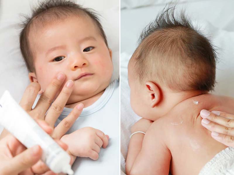 Newborn baby 2024 skin care