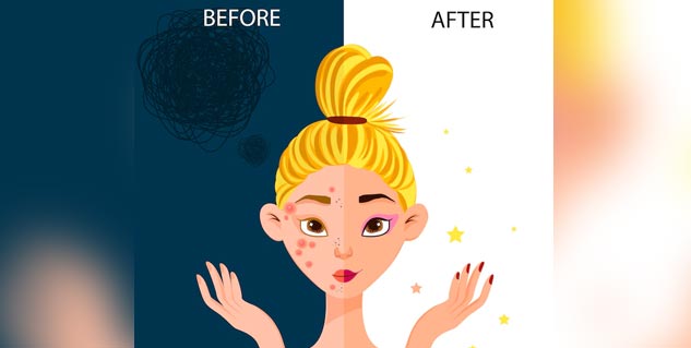 before_after