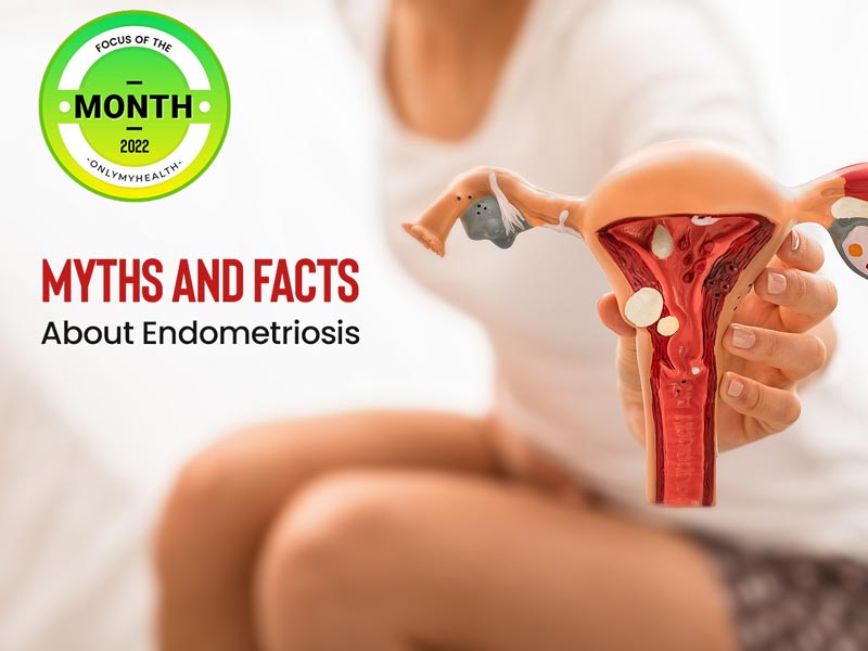 Endometriosis: 7 Myths And Facts Debunked For Women's Health