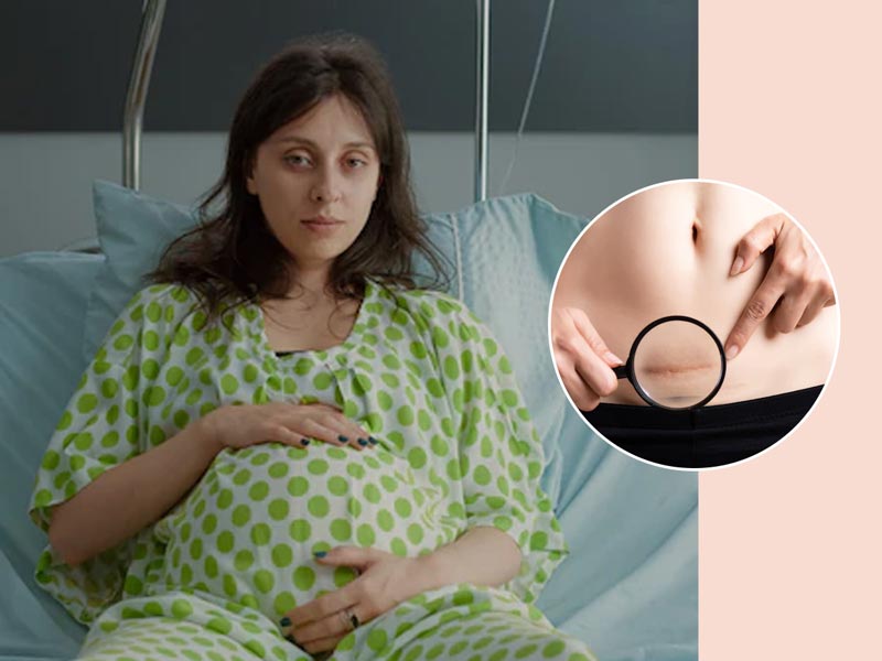 Common C-Section Questions That A Woman Must Ask Her Gynaecologist