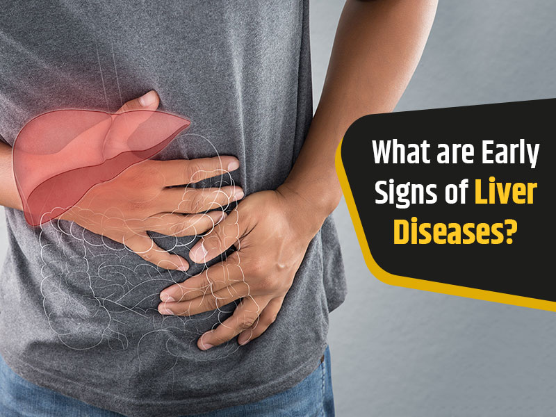 How To Recognize Early Signs Of Liver Diseases Know From Expert Onlymyhealth 