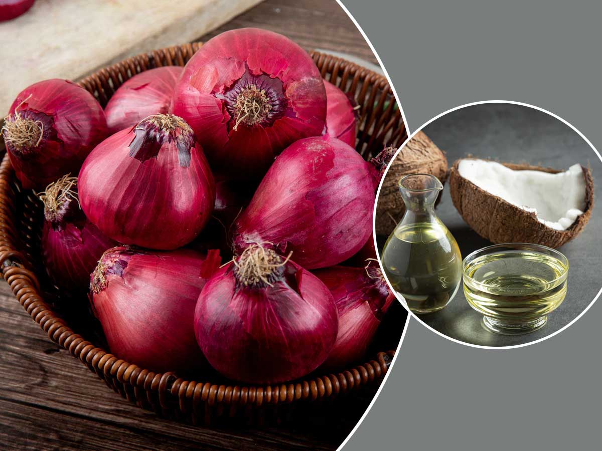 बालों के लिए प्याज के तेल (ऑनियन ऑयल) के फायदे और घर पर बनाने का तरीका | onion  oil benefits for hair in hindi