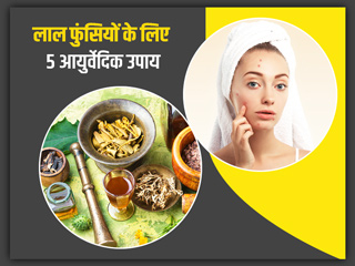 चेहरे पर लाल फुंसियां क्यों हो जाती हैं? जानें इसे दूर करने के 4 आयुर्वेदिक उपाय