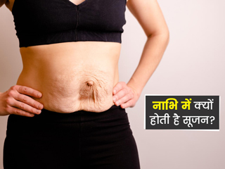 नाभि क्यों फूलती है? जानें नाभि में सूजन के कारण और इसका खतरा बढ़ाने वाले कारक