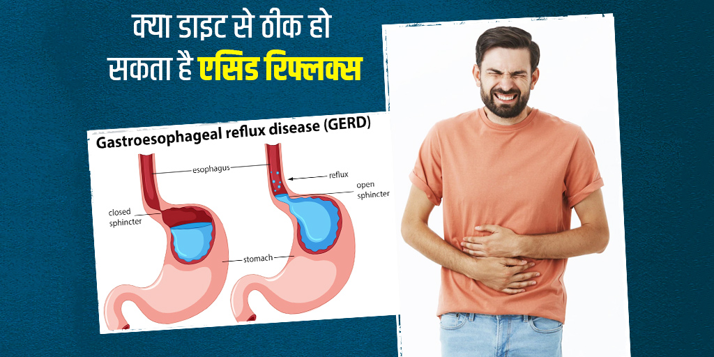 gerd-can-acid-reflux