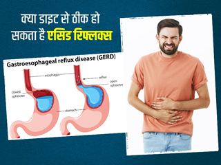 क्या एसिडिटी और सीने में जलन को डाइट से ठीक किया जा सकता है? जानें एक्सपर्ट की राय