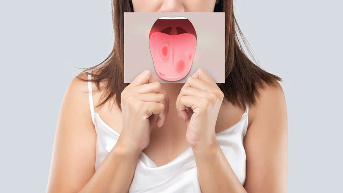 Home Remedies for mouth ulcer in hindi