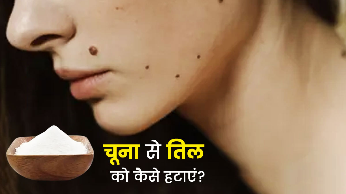तिल हटाने के लिए इन 4 तरीकों से इस्तेमाल करें चूना