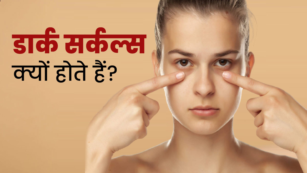 डार्क सर्कल्स क्यों होते हैं? जानें इनसे छुटकारा पाने के आयुर्वेदिक उपाय