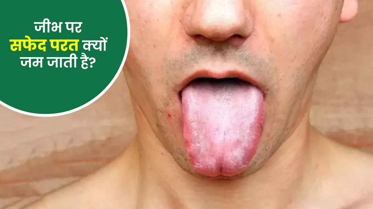 जीभ पर सफेद परत क्यों जम जाती है ? एक्सपर्ट से जानिए इसके कारण