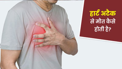 हार्ट अटैक से मौत कैसे होती है? जानें डॉक्टर से