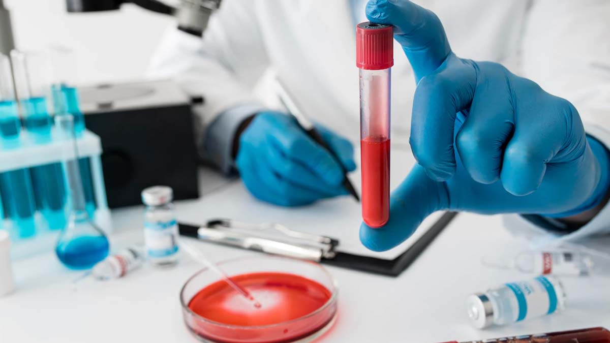 What To Eat Or Not In Blood Infection in hindi