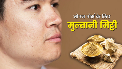 Open Pores: चेहरे पर हो गए हैं गड्ढे, तो इन 4 तरीकों से लगाएं मुल्तानी मिट्टी