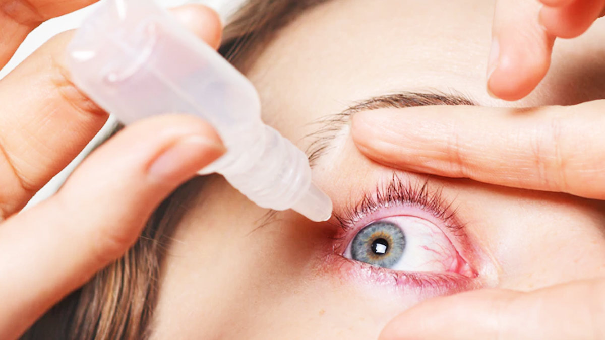 eye infection monsoon 