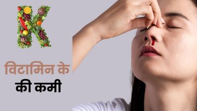विटामिन के की कमी से कौन सी बीमारी होती है? जानें डॉक्टर से