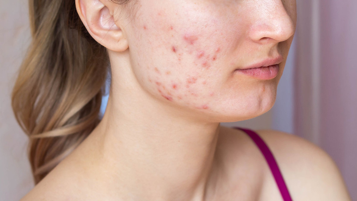 Skin Care in Hindi