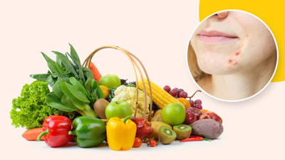 सर्जरी के बाद स्किन को जल्दी रिपेयर करने के लिए खाएं ये चीजें