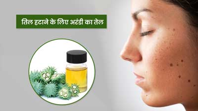 तिल हटाने के लिए इन 4 तरीकों से इस्तेमाल करें अरंडी का तेल