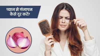 प्याज से गंजापन कैसे दूर करें? जानें 5 तरीके