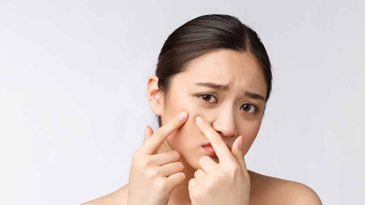 acne treatment