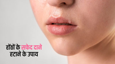 होठों पर सफेद दानों को कम करने के लिए अपनाएं ये 5 घरेलू नुस्खे
