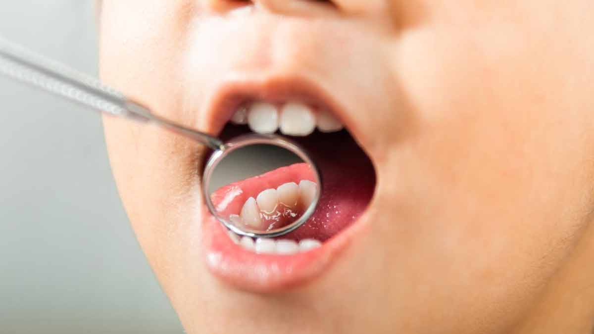 Know From Expert Why Do Babies Get More Cavity Problems