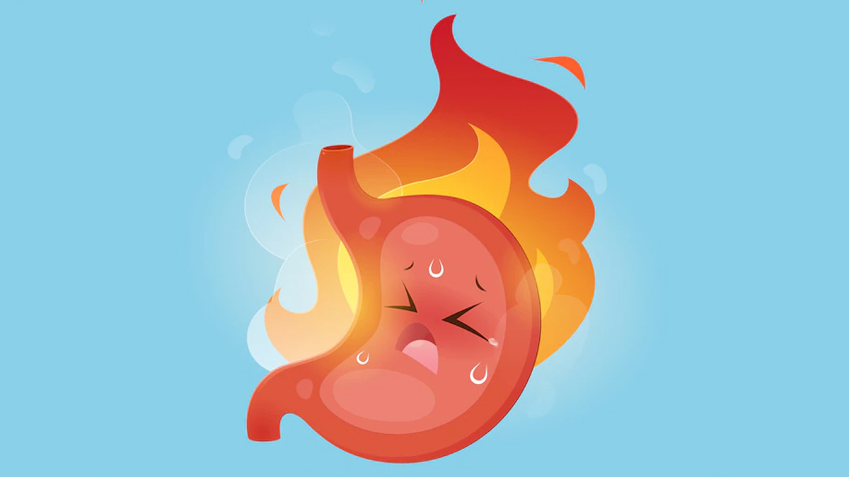acidity tips in hindi 