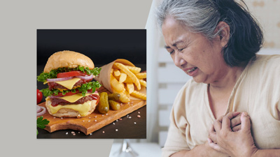 कोलेस्ट्रोल बढ़ने पर इन चीजों का न करें सेवन, जानें परहेज का तरीका 