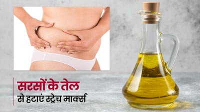 सरसों के तेल से स्ट्रेच मार्क्स कैसे कम करें? जानें तरीका