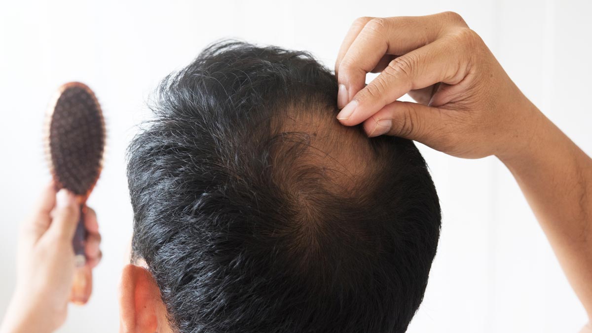 does-diabetes-causes-hairloss