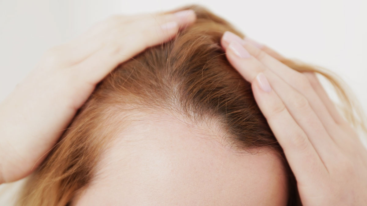 Nutrients Deficiency Causes Baldness
