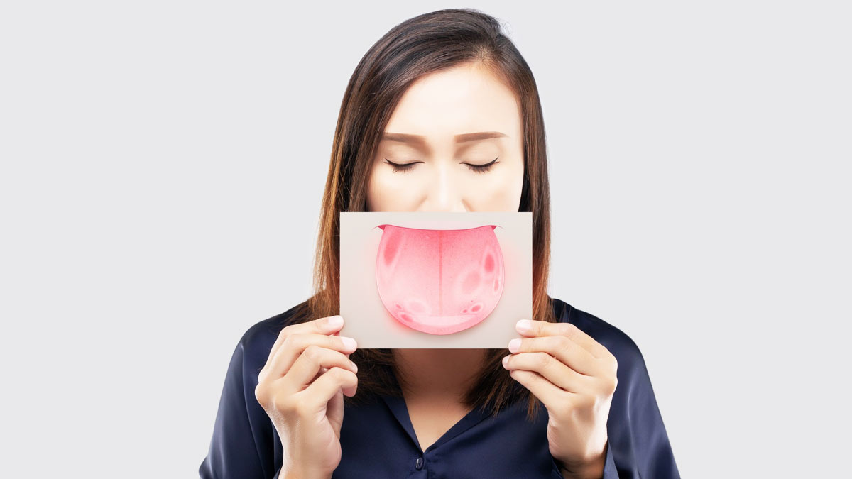 4 Causes Of Canker Sores On The Tongue