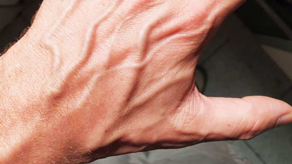 visible veins on hand