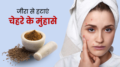 जीरा पाउडर से दूर करें चेहरे के मुंहासे, इस तरह करें इस्तेमाल