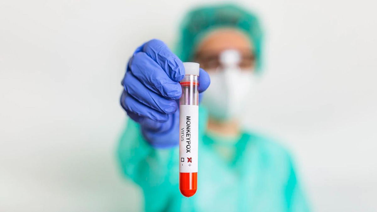  WHO Changed The Name of Monkeypox