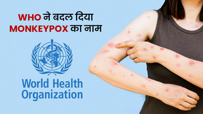 WHO ने बदल दिया Monkeypox का नाम, नाम बदलने के पीछे है ये वजह