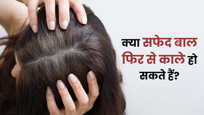 क्या सफेद बाल फिर से काले हो सकते हैं? जानें एक्सपर्ट की राय