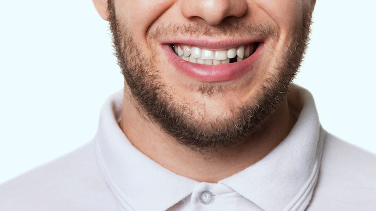What Are The Treatment Options Available For Chipped Teeth