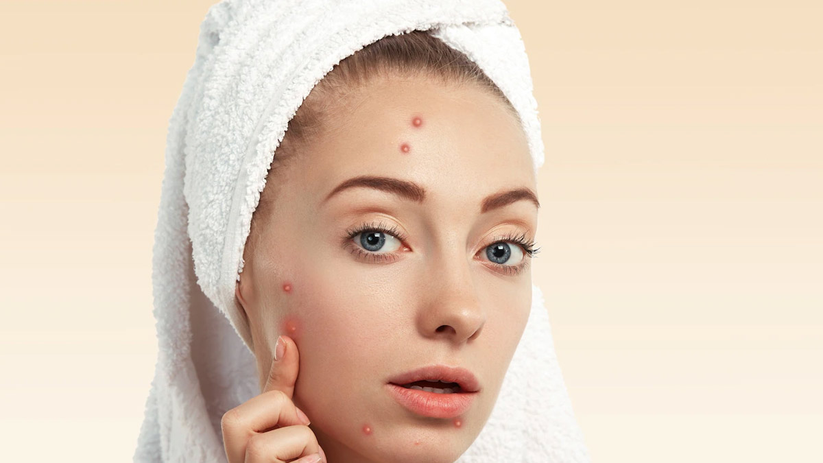 Fenugreek Benefits For Acne-Pimples