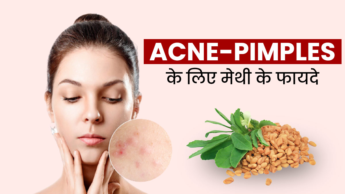 Acne-Pimples का रामबाण उपाय हैं मेथी के बीज, जानें कैसे करें प्रयोग