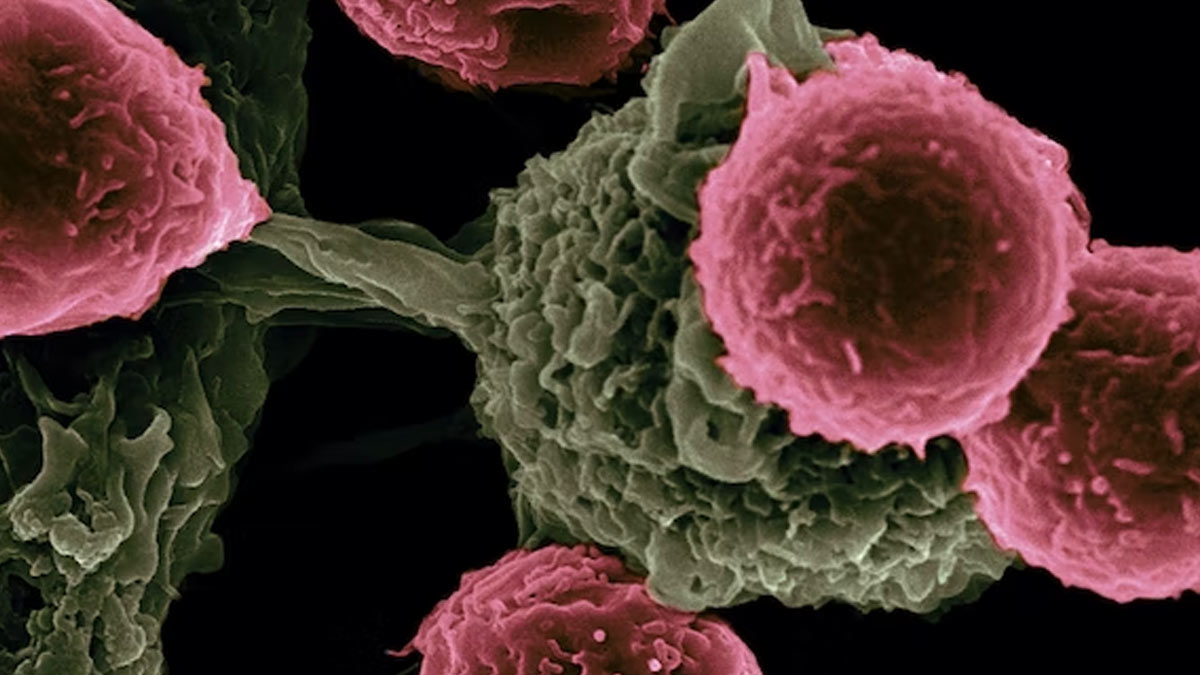 Researchers Find Mechanism That Lets Cancer Cells Spread Through The Body