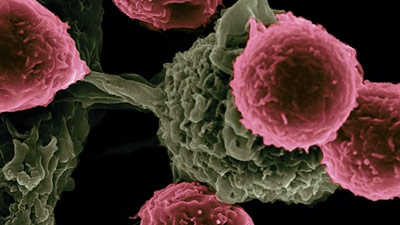 Researchers Find Mechanism That Lets Cancer Cells ...
