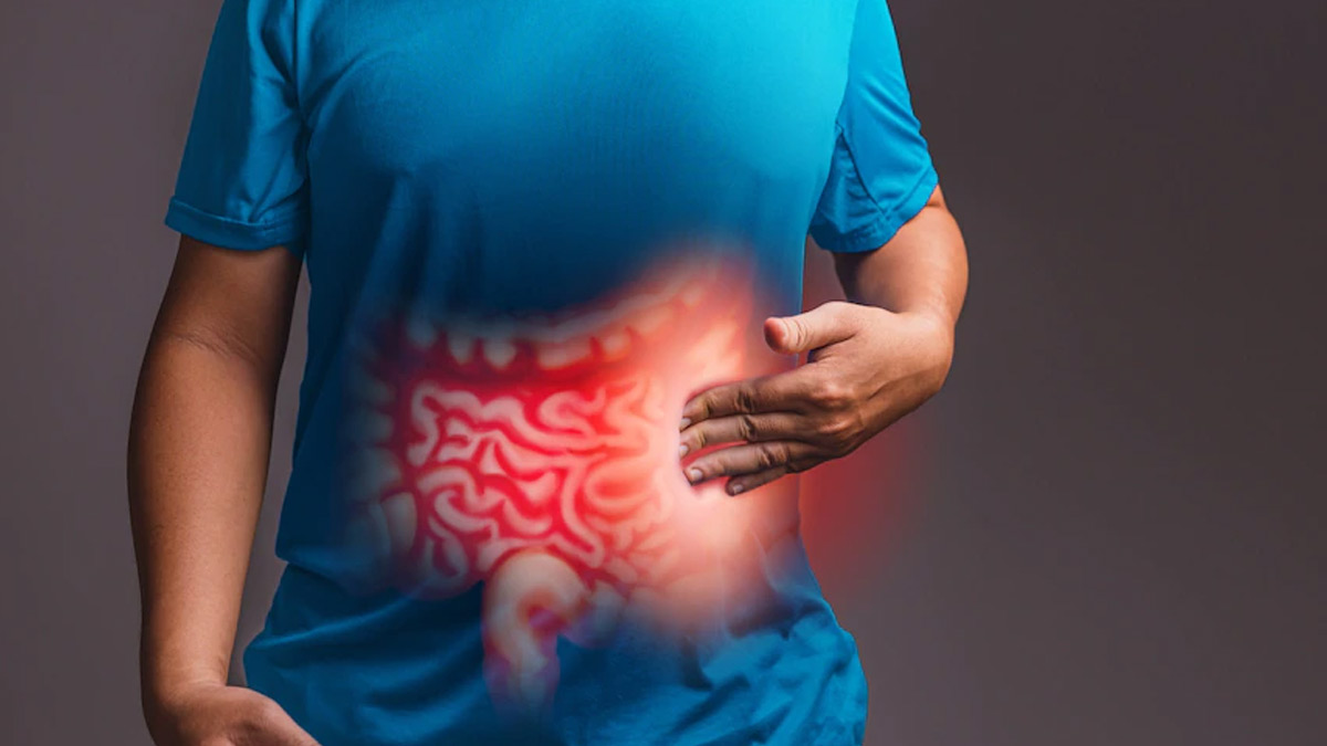 Gravity May Cause Irritable Bowel Syndrome, Suggests Study