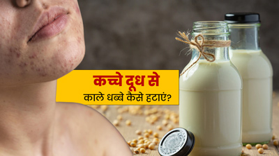 कच्चे दूध से चेहरे के काले धब्बे कैसे हटाएं? जानें प्रयोग के 3 तरीके 