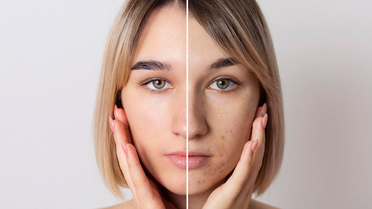 how to use raw milk to reduce dark spots