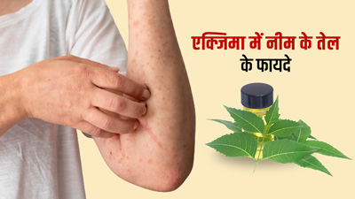 एक्जिमा का रामबाण इलाज है नीम का तेल, जानें कैसे करें प्रयोग