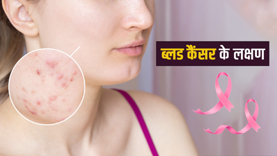 ब्लड कैंसर होने पर स्किन पर दिखाई देते हैं ये लक्षण, न करें नजरअंदाज