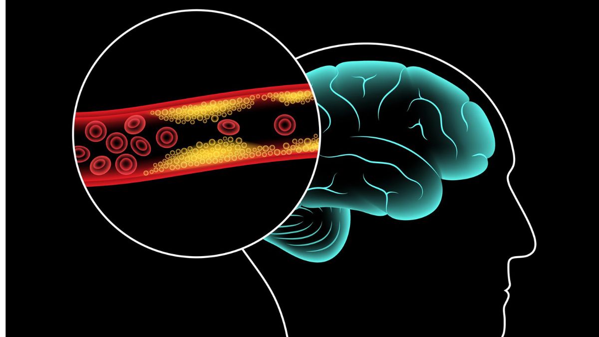 Blood Circulation In Brain In Hindi