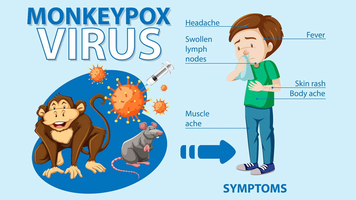 Reports Of Mpox Infection Following Recent Vaccination Drives